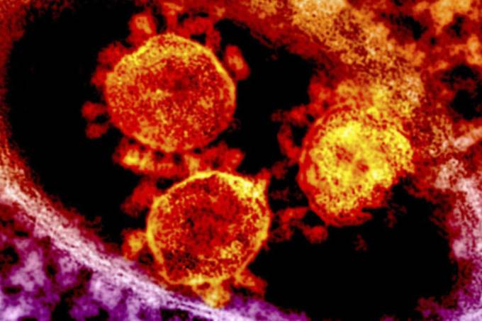 9 suspeitas de coronavírus são monitoradas no país